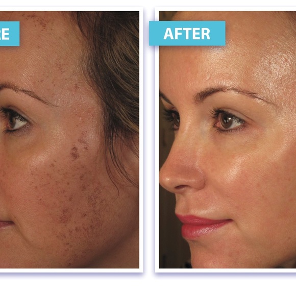 Shani Darden by Déesse PRO LED Light Mask FDA approved 
LED Light Therapy mask - Picture 8 of 12